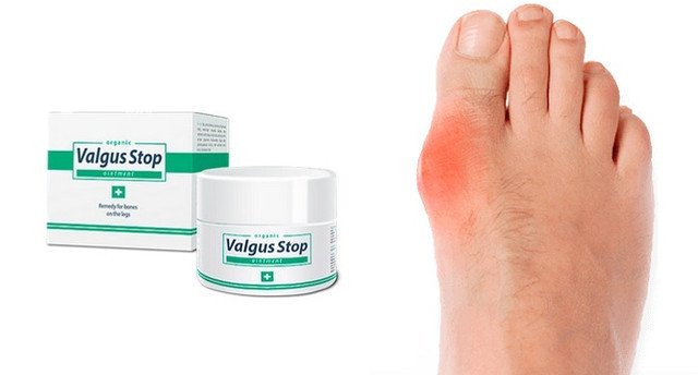 VALGUSSTOP крем от вальгусной деформации стопы