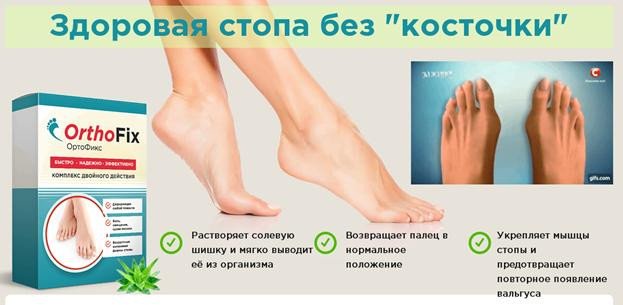 OrthoFix (ОртоФикс) – комплекс от вальгуса стопы